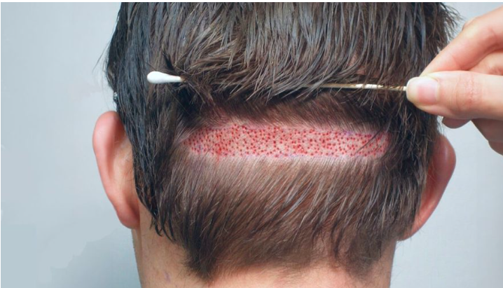How to Choose the Right Hair Specialist in Lahore for Your Needs