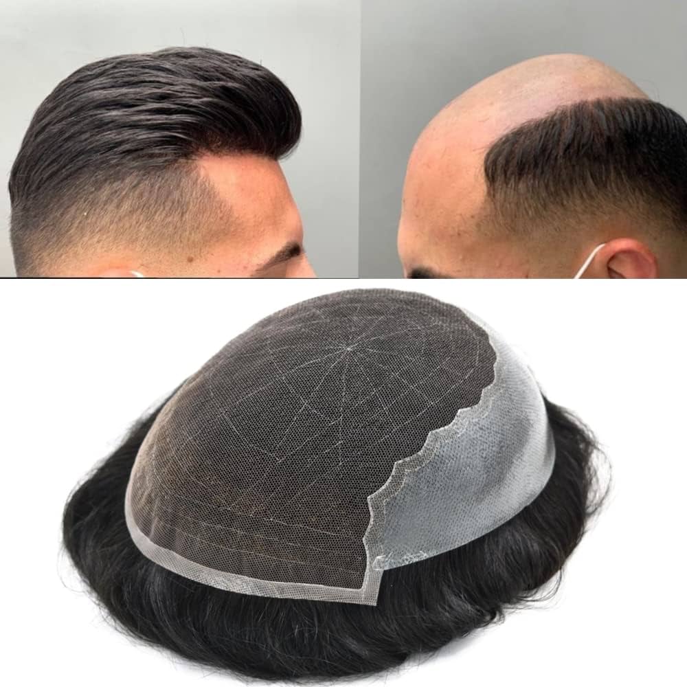 Hair Systems for Men