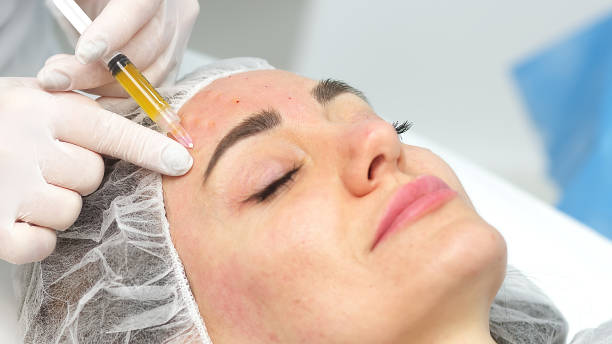 PRP Treatment for Face Cost: What You’ll Really Pay in 2025