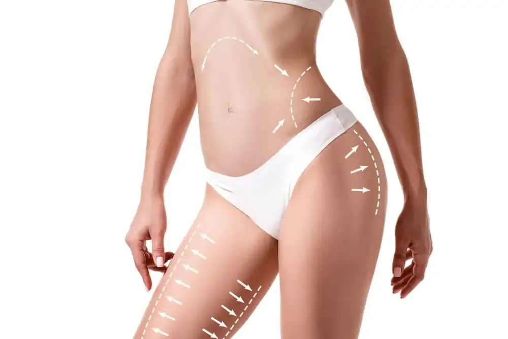 The Science Behind Fat Cells: How Liposuction Actually Works