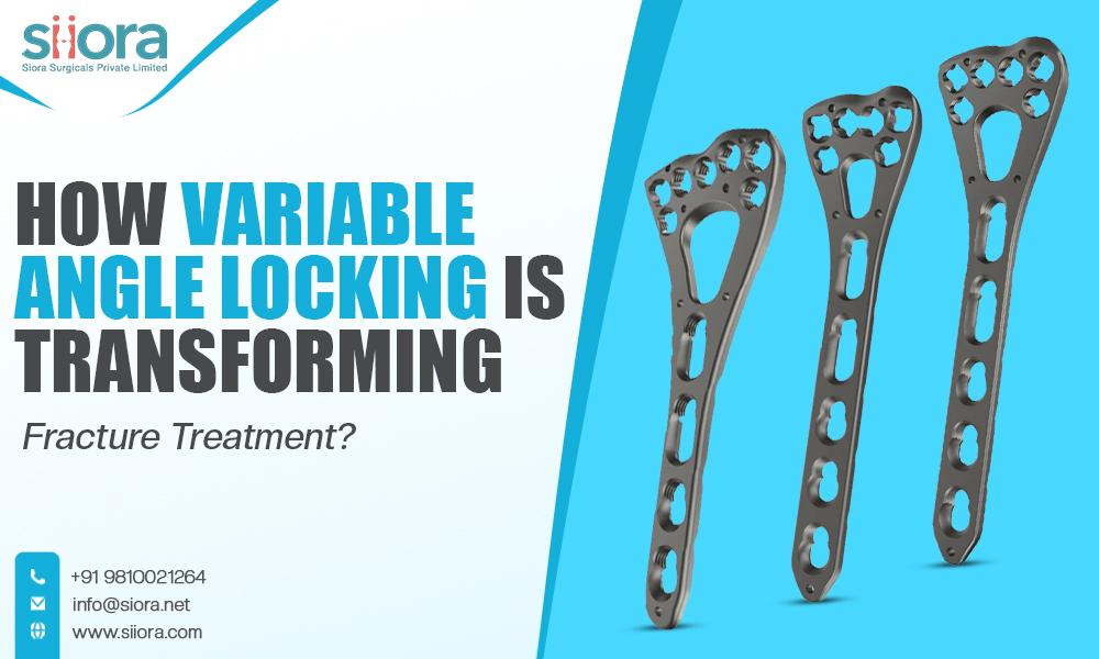 How Variable Angle Locking Is Transforming Fracture Treatment?