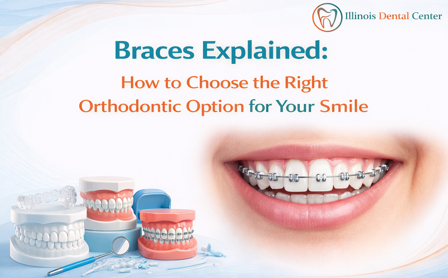 Braces Explained: How to Choose the Right Orthodontic Option for Your Smile
