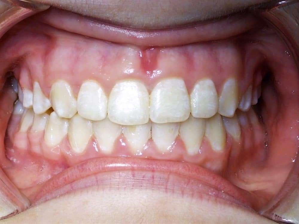How Do You Choose the Right Orthodontist in North Miami Beach?