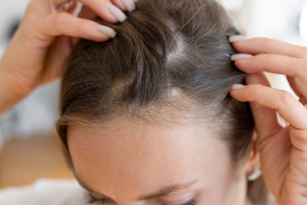 Transform Your Hair Naturally with Expert Treatments in Islamabad
