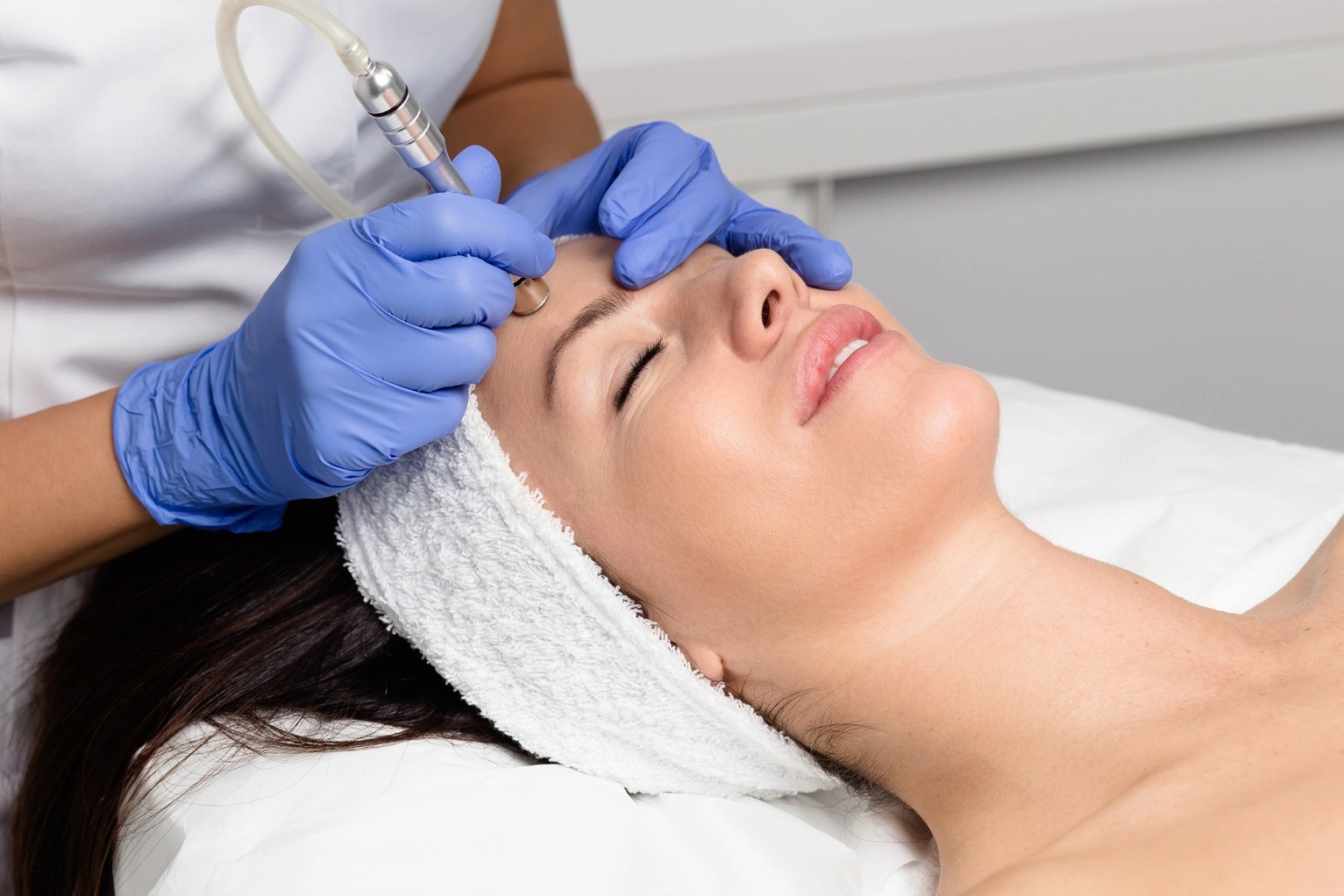 microdermabrasion in islamabad