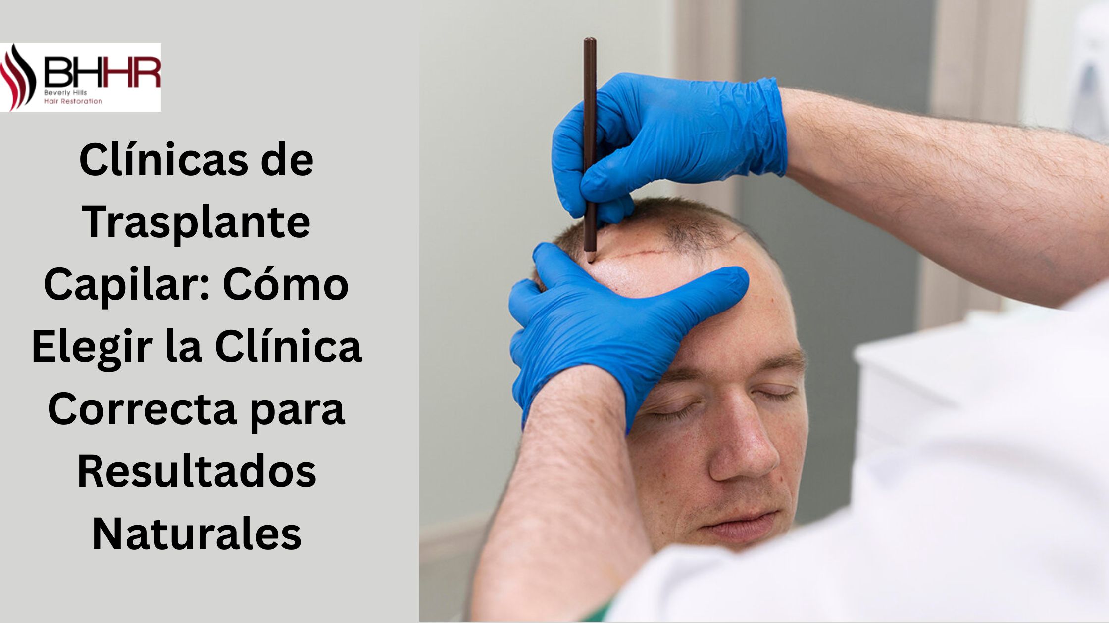 clinicas de implante capilar