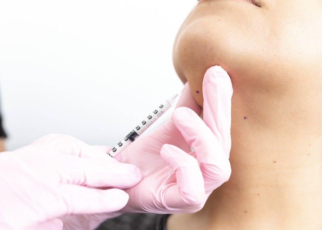 belkyra treatment