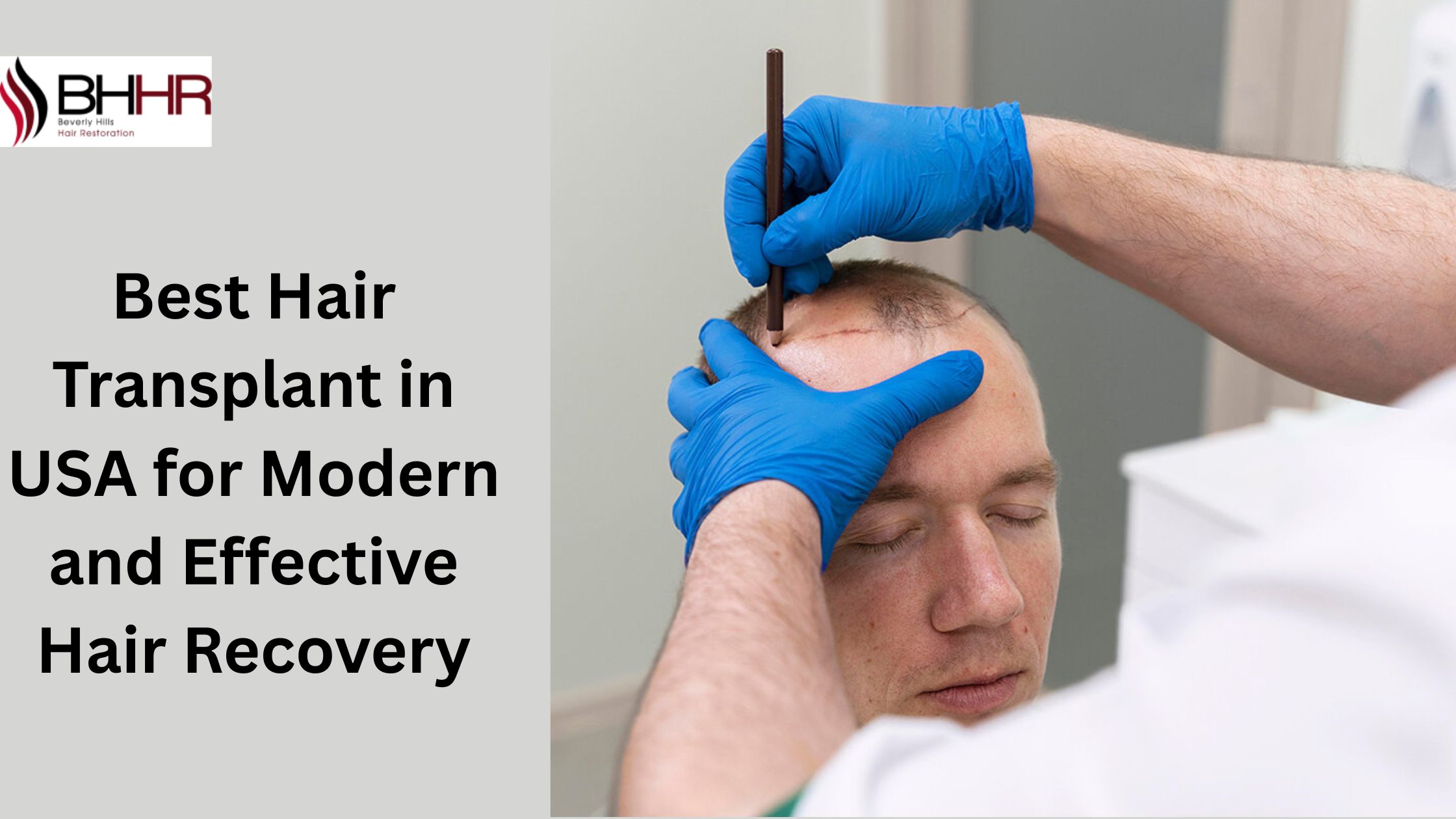 Best Hair Transplant in USA for Modern and Effective Hair Recovery