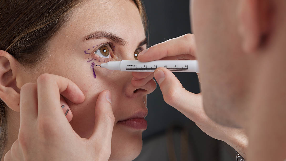 What Is the Best Age for Blepharoplasty in Islamabad?