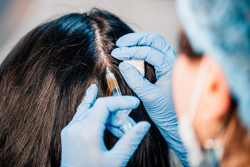 Exosomes Hair Therapy in Islamabad: Before and After Results
