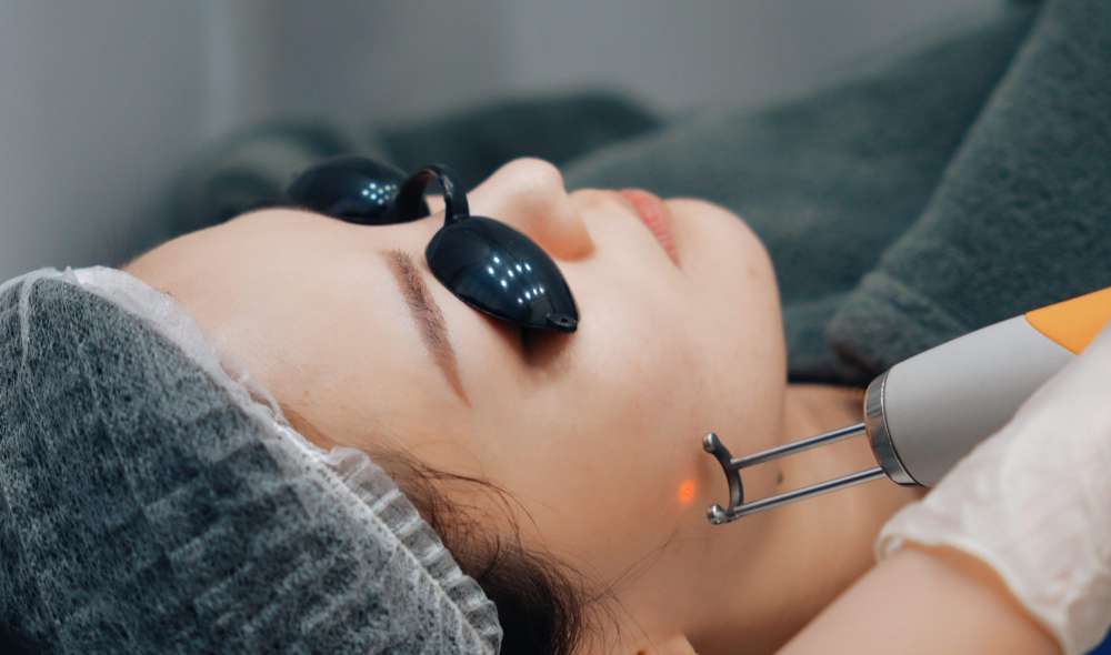 How Many Sessions of PICO Laser Treatment In Islamabad Do You Need?