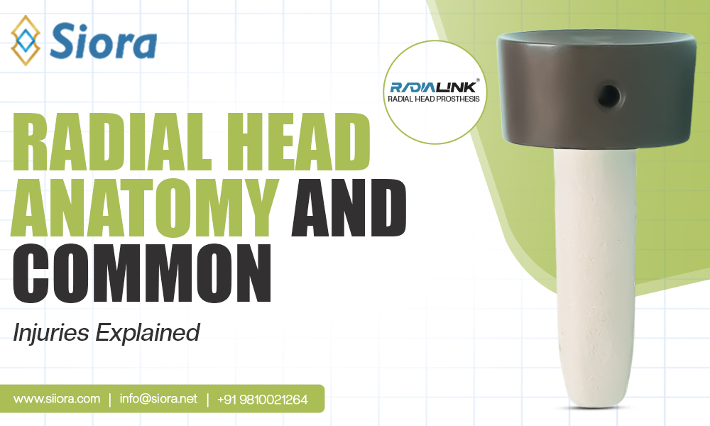 Radial Head Anatomy and Common Injuries Explained