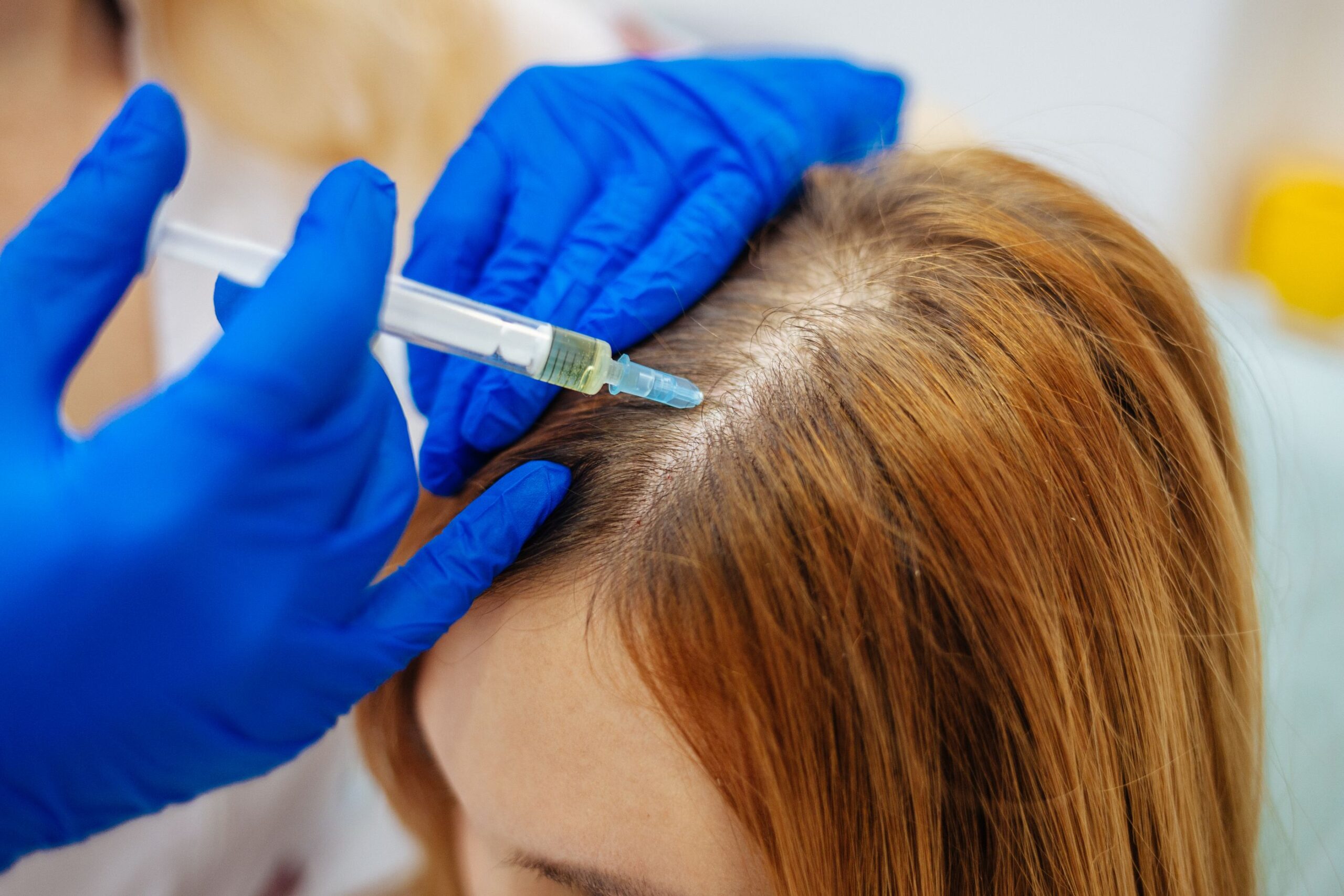 Hair Regeneration Experts for Exosomes Hair Therapy in Islamabad