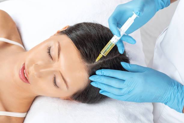 PRP Hair Therapy Effective Solution for Hair Fall and Thinning