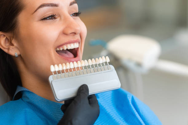 Teeth Whitening in Riyadh for High-End Cosmetic Dentistry