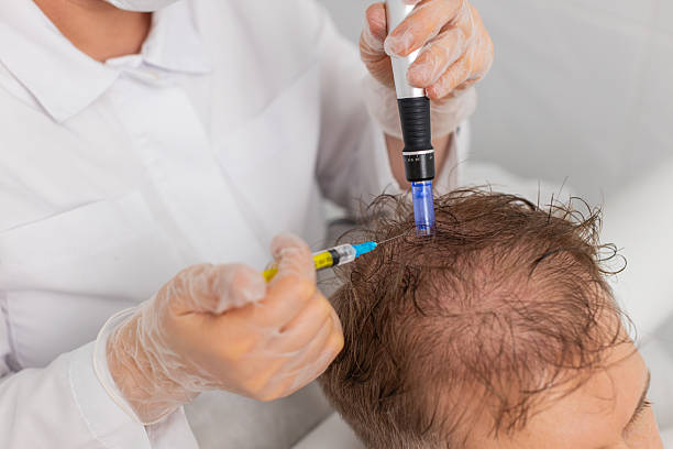 Exosome Hair Therapy in Islamabad: Myths vs Facts You Should Know