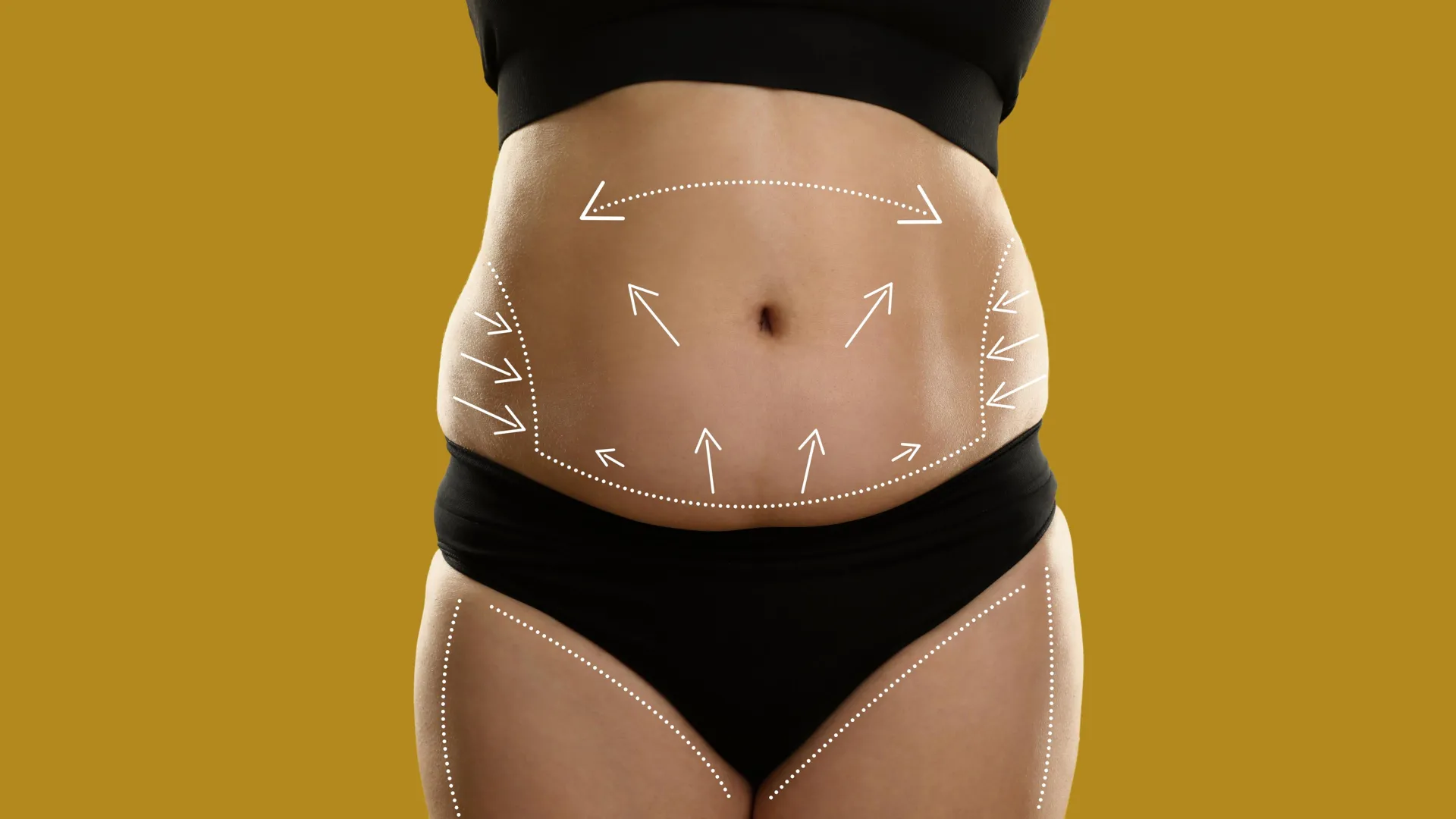tummy tuck surgery