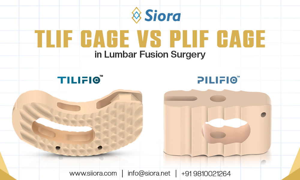 TLIF Cage vs PLIF Cage in Lumbar Fusion Surgery