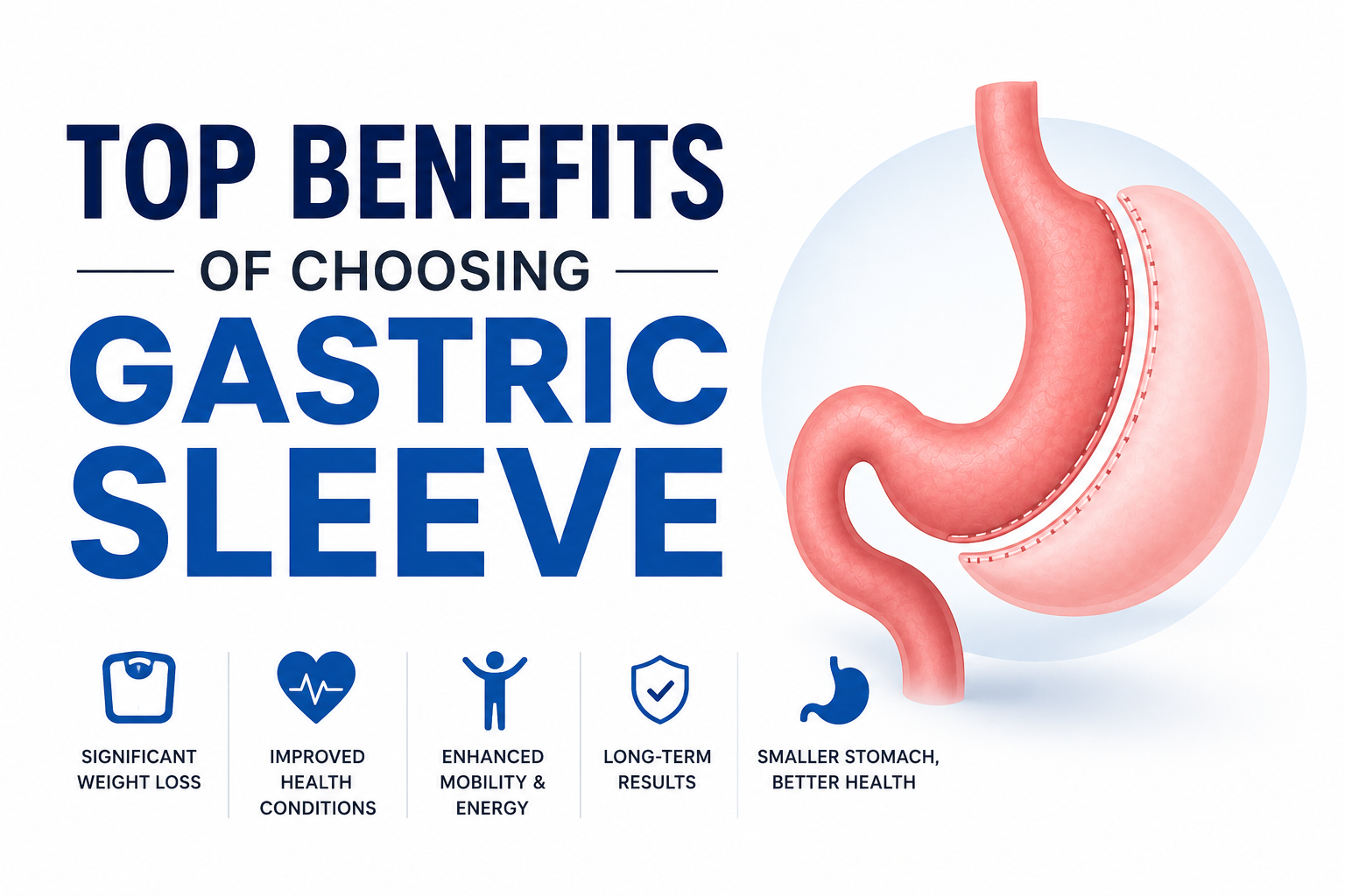 Top Benefits of Choosing Gastric Sleeve
