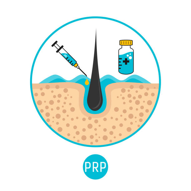 How Stress and Hormones Affect Your Results PRP Hair Treatment in Islamabad: