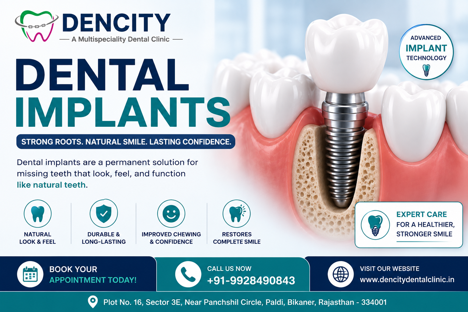 Dental Implant Dentist,