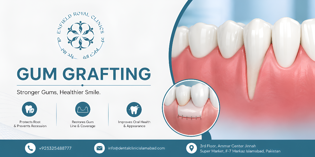 Gum Grafting in Islamabad: Restore Healthy Gum Contours