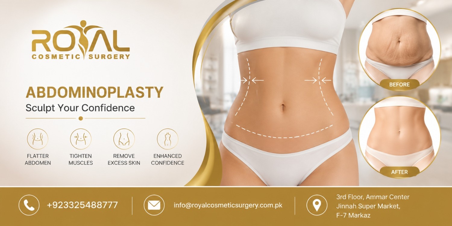 abdominoplasty