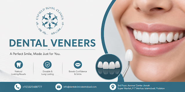 Get a Celebrity Smile with Dental Veneers in Islamabad