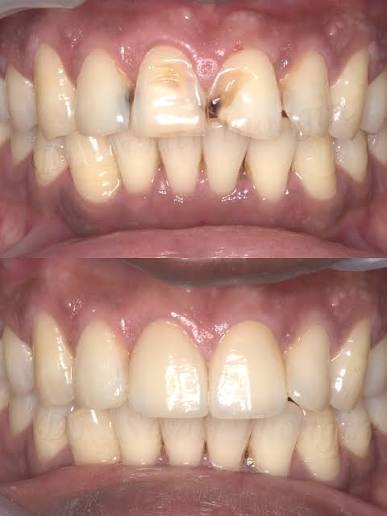 Cosmetic Dentist in Thane West for Modern Dental Solutions