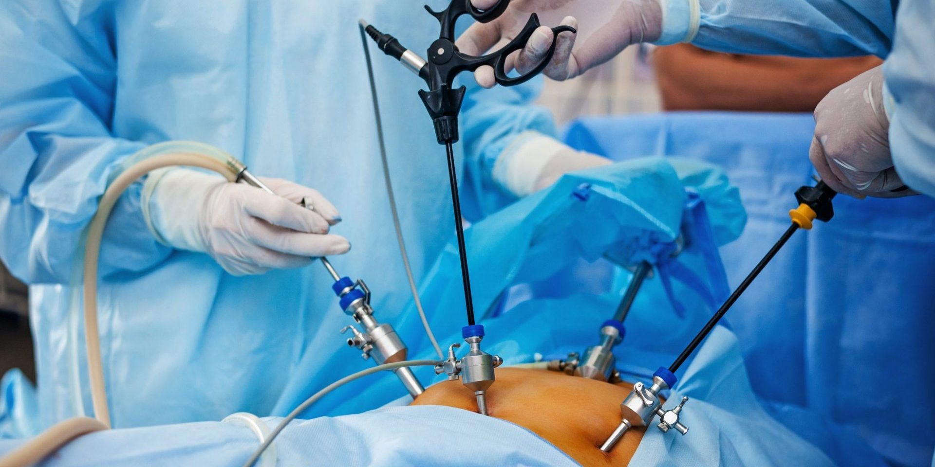 How to Find a Reliable Laparoscopic Surgery Specialist?
