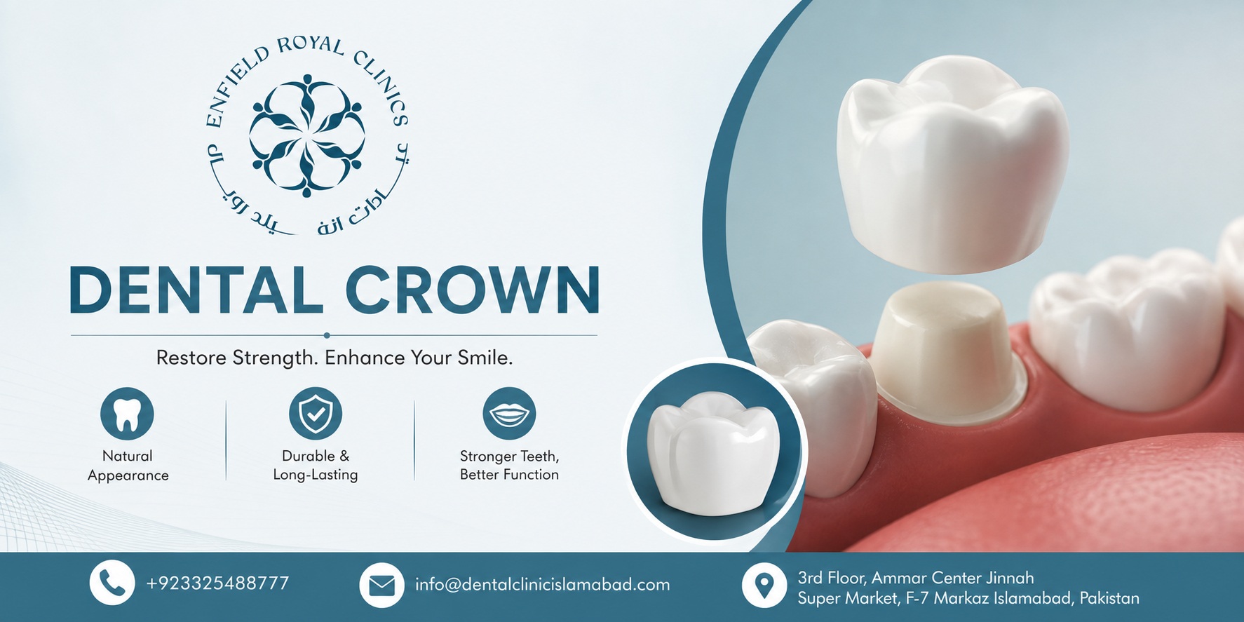 Restore Your Teeth With Dental Crowns in Islamabad