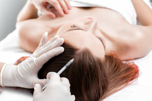 Does Exosome Therapy Help Improve Hair Vitality?