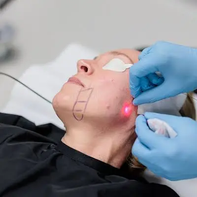 How Does Endolift Reduce Facial Sagging Signs?