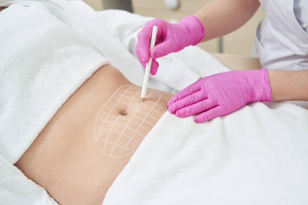 How does Non-surgical Fat Reduction help achieve a slimmer shape