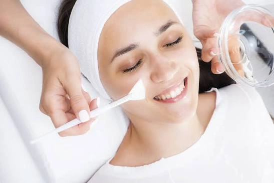 Is Chemical Peels Good for Acne Scars and Marks?