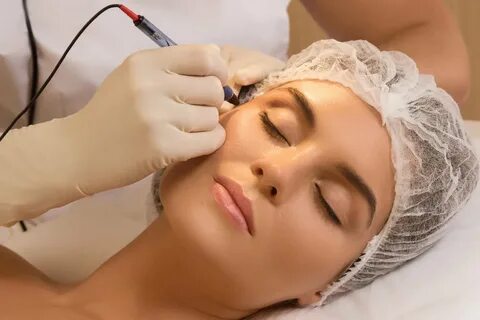 Is Electrolysis Treatment Suitable for Darker Skin Tones