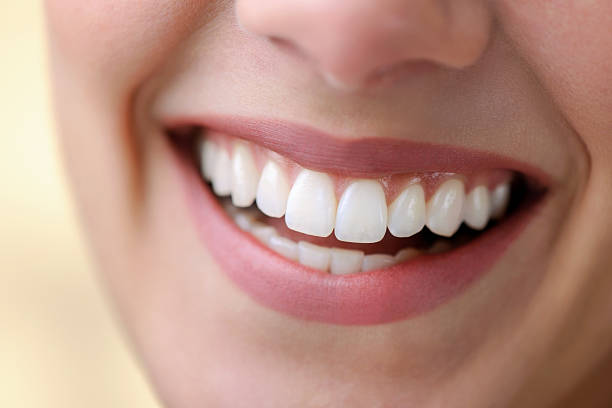 Is Teeth Whitening effective for yellow-looking teeth