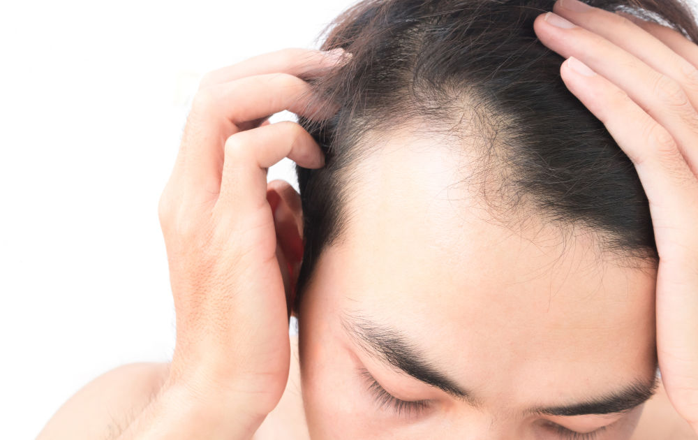 Hair Transplant in Dubai