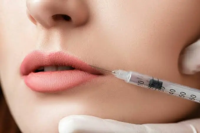 What Makes Russian Lip Fillers So Popular Today?