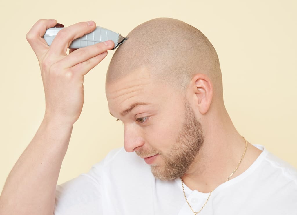 Scalp Micropigmentation Dubai