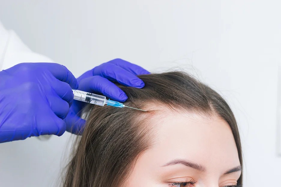 Stem Cell Hair Transplant in Dubai