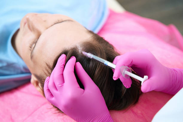 Can Best PRP Hair Treatment help thinning temples
