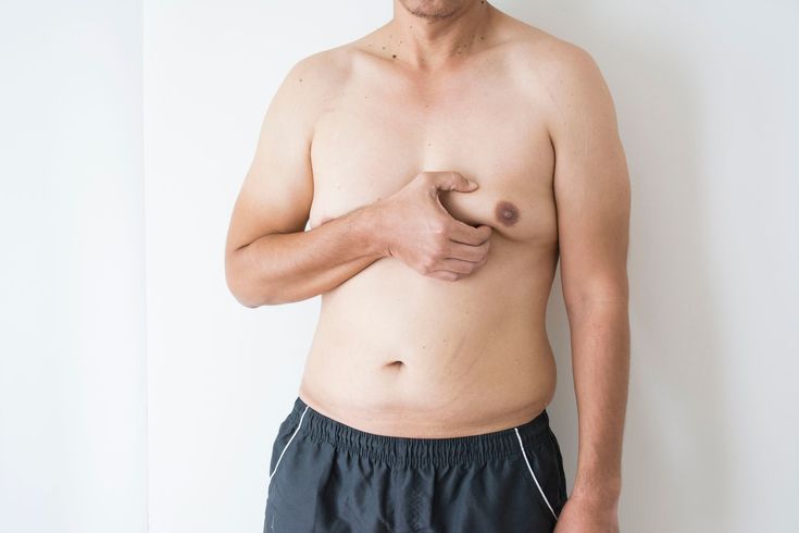 What Should You Consider Before Gynecomastia Surgery in Dubai?