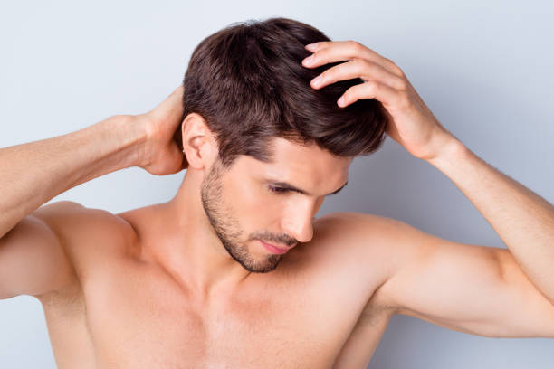 Can FUE Hair Transplant restore hairline confidence