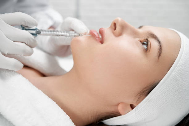 Can Lip Filler Injections Define the Lip Border