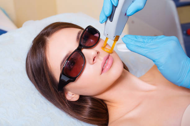 Can Pico Laser Treatment improve overall skin clarity