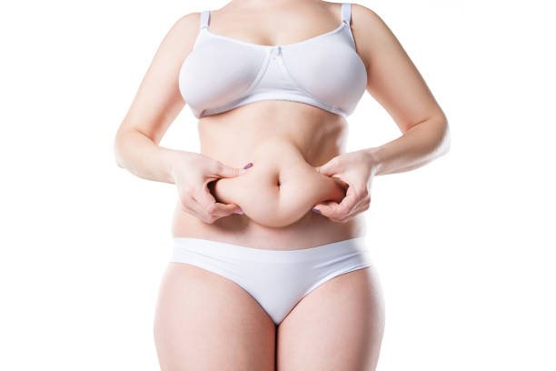 Does Mini Abdominoplasty require time away from work