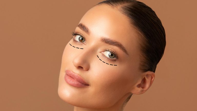 Top Options for Eyelid Surgery Dubai Price