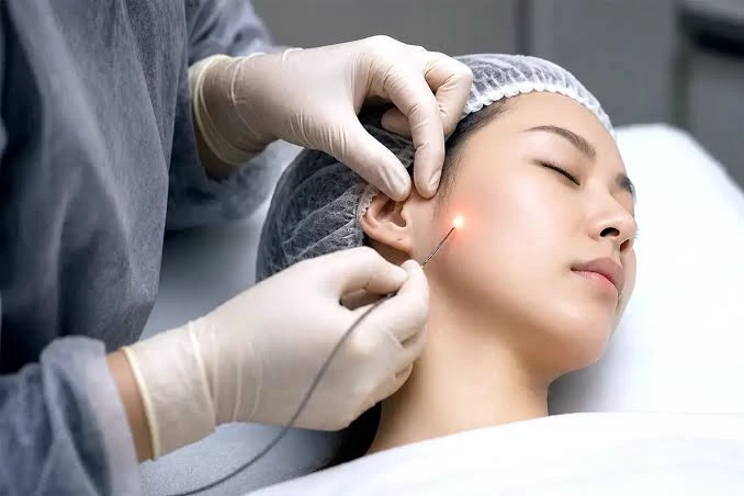 How Can Endolift in Refresh Tired-Looking Facial Skin