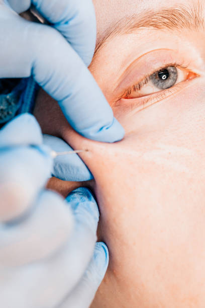 How Can Under Eye Fillers Brighten Tired Eyes